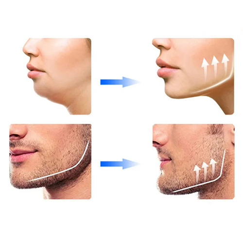 1 par Jawline Light Bite