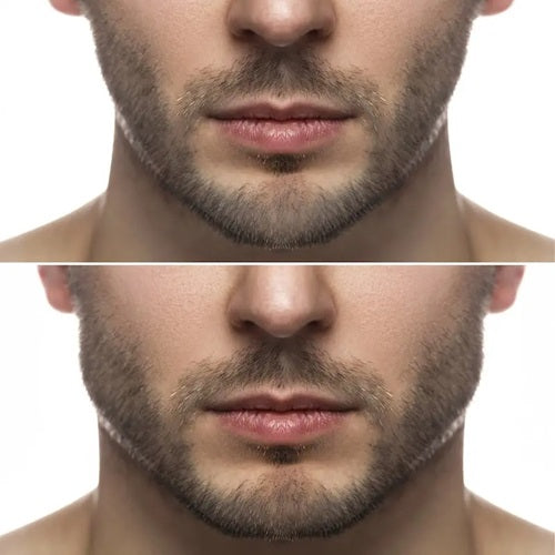 1 par Jawline Light Bite